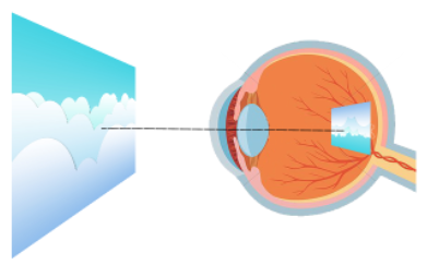 how the retina works